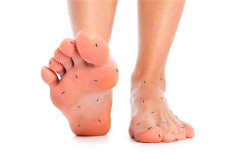 Diabetes And Feet Diabetic Neuropathy Symptoms