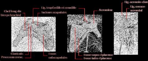 Anatomie Du Membre Superieur Laboratoire D Anatomie