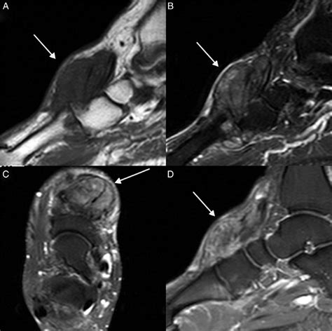 Sagittal Mri Images T Weighted A T Weighted B Axial