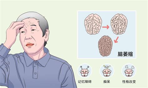 小脑共济失调共济失调一样吗？共济失调小脑步态新浪新闻