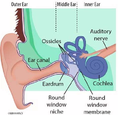 Scheme Of The Anatomic Structures Of Outer Ear Middle Ear And Inner