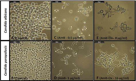 In Vitro Evaluation Of Antifungal And Cytotoxic Activities As Also The