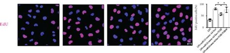 Adipocyte Derived Exosomal Mir 122 5p Reinforces The Pulmonary