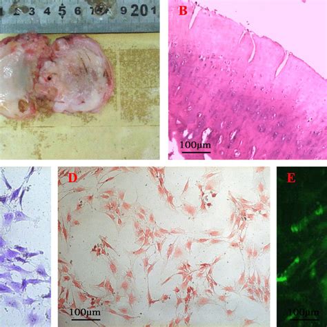 Characterization and identification of cartilage and chondrocytes. A... | Download Scientific ...