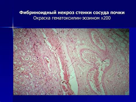 Дистрофии. Классификация - презентация онлайн