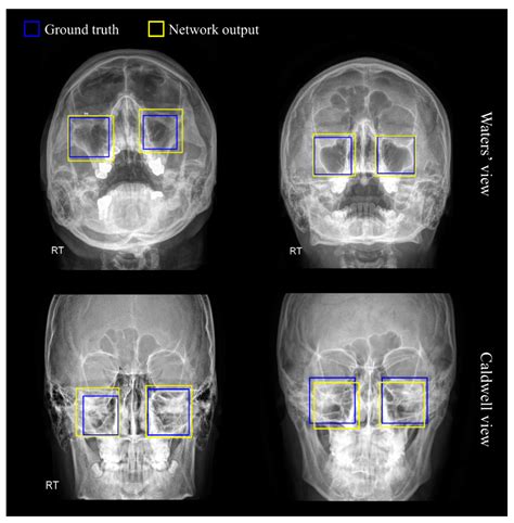 Diagnostics Free Full Text Aux Mvnet Auxiliary Classifier Based Multi View Convolutional