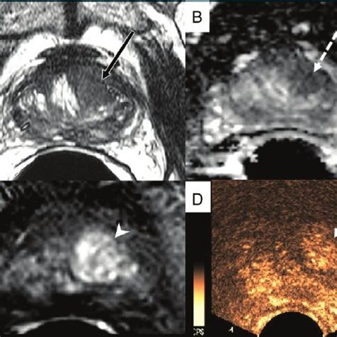 A Axial T Weighted Spin Echo Mr Image Repetition Time Msec Echo Time