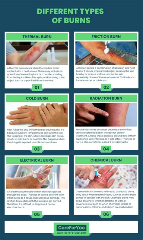 Best Ointments And Creams For Burns Care For Yoo