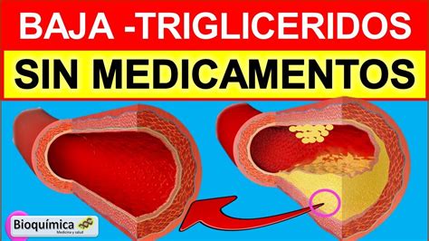 Baja Los Trigliceridos Sin Medicamentos Youtube