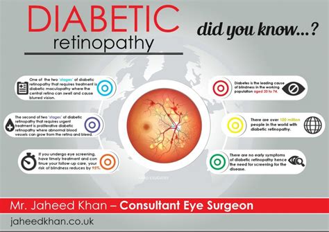 stages of diabetic retinopathy - Maria Morgan