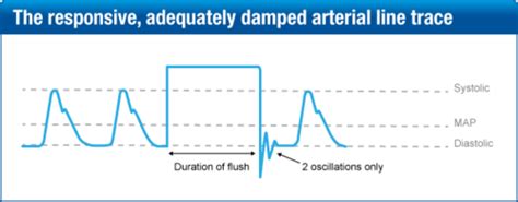 Hemodynamic Monitoring Flashcards Quizlet