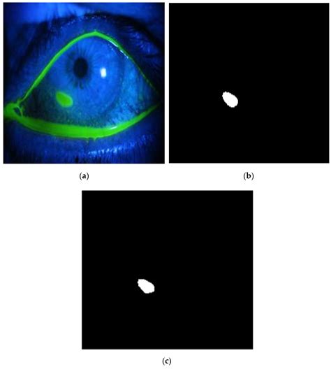 Diagnostics Free Full Text Automated Detection Of Corneal Ulcer Using Combination Image