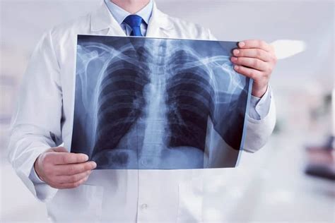 X-Ray | South Coast Radiology