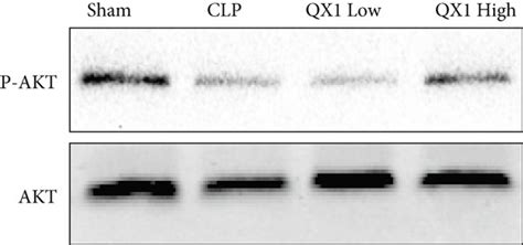 Effects Of The Qx Formula On The Sepsis Induced Cardiac Dysfunction