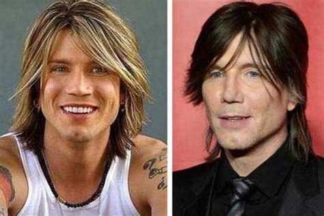 John Rzeznik Plastic Surgery Nose Job Facelift Botox