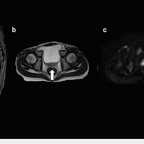 Magnetic Resonance Imaging A Contrast Enhanced T1 Weighted Image Download Scientific Diagram