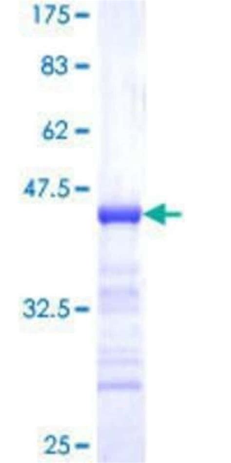 Novus Biologicals Recombinant Human Timeless GST N Term Protein