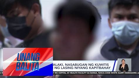 15 Anyos Na Lalaki Nasabugan Ng Kuwitis Na Sinindihan Ng Lasing Niyang