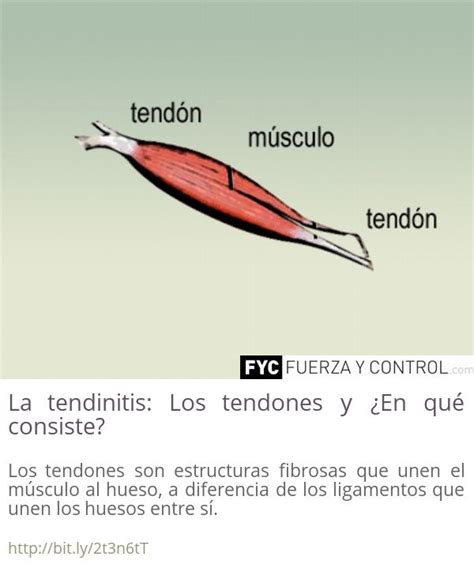 La tendinitis Los tendones y En qué consiste Tendinitis Musculos