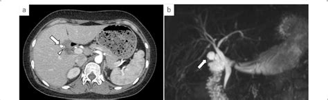 Abdominal Contrast Enhanced Ct And Mrcp Images A Contrast Enhanced Download Scientific Diagram