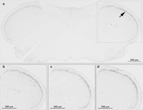 Representative Histological Images Following C Fos Immunostaining In