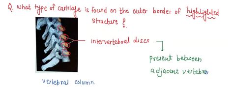 Solved Axial Skeleton Vertebral Column Lab Practical Question