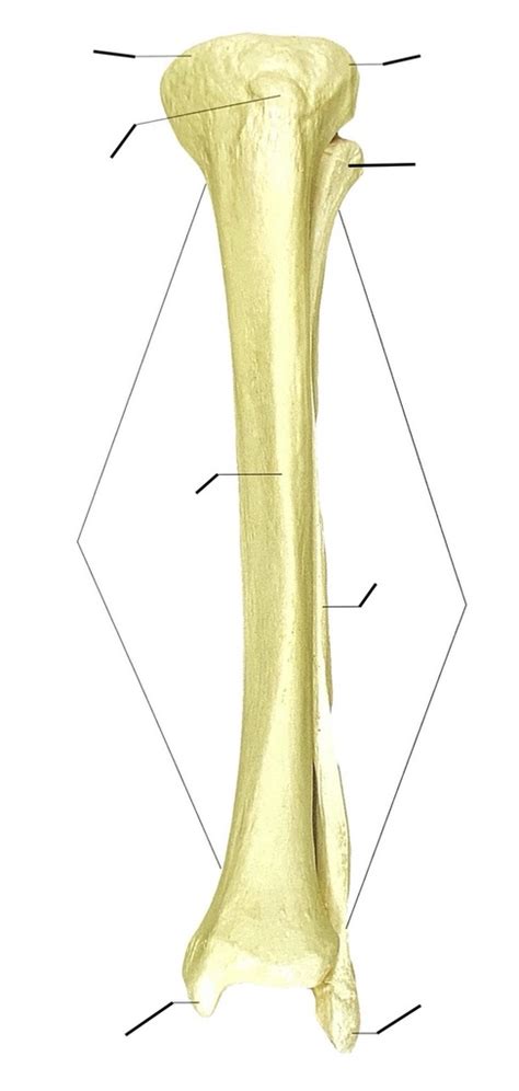 A P 1 Lab Tibia Fibula Bone Markings Left Anterior View 1 2