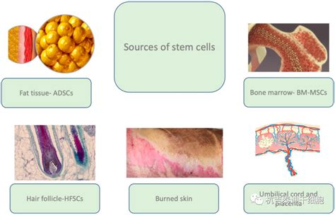 间充质干细胞丨处理修复烧伤的新希望 杭吉干细胞科技