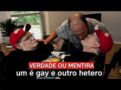 Irm Os Siameses Um Gay E Outro Hetero Verdade Ou Mentira Youtube