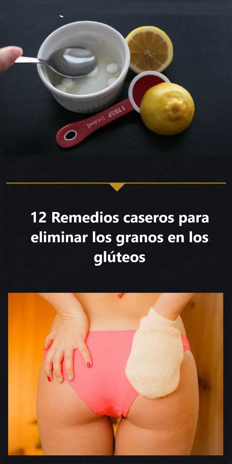 12 Remedios caseros para eliminar los granos en los glúteos Granos en