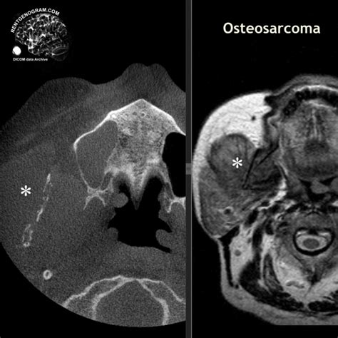 Dicom Soft Tissue Body