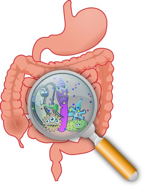 High Prevalence Of Small Intestinal Bacterial Overgrowth Sibo In