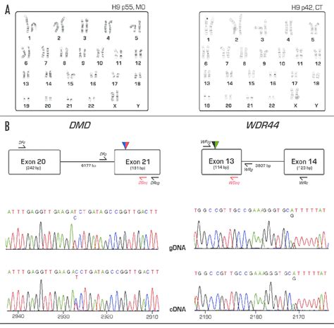 Cytogenetic Analysis Snp Genotyping And Snp Expression Analysis Of Two