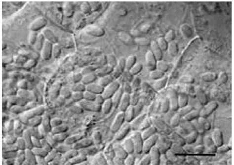 Synechococcus Sp Cells Between Periostracum And The Mineralized Shell