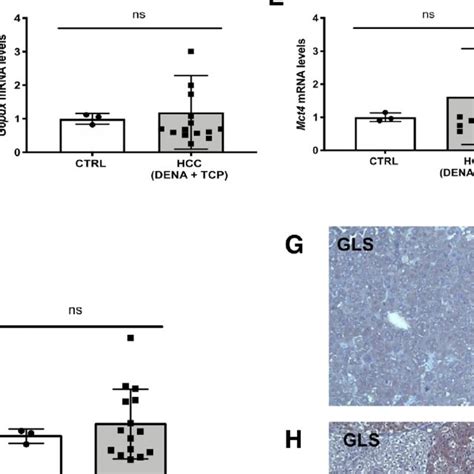 Qrt Pcr Analysis Of G6pc Glut1 Hk2 G6pdx Mct4 And Gls In Hccs Of