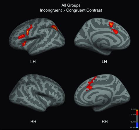 Whole Brain Activation For Incongruent Congruent Trials Of The Fmri Download Scientific