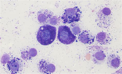 Mast cell tumor – eClinpath