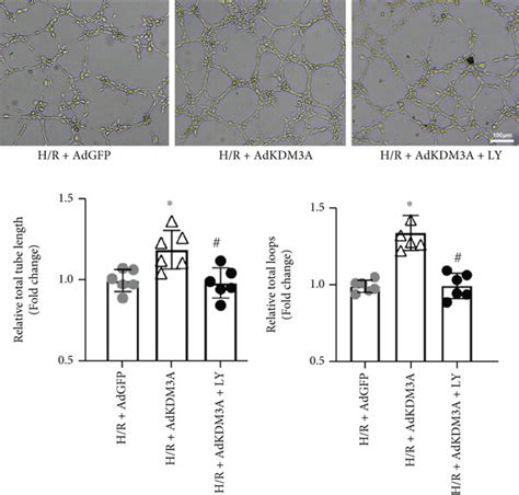 KDM3A Overexpression Ameliorated H R Induced CMEC Injury And