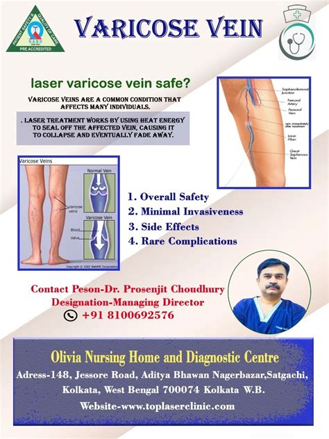 Is Laser Varicose Vein Safe Top Laser Clinic