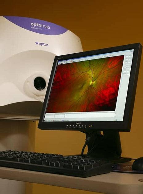 Optomap Ultra Wide Retinal Imaging Now Available