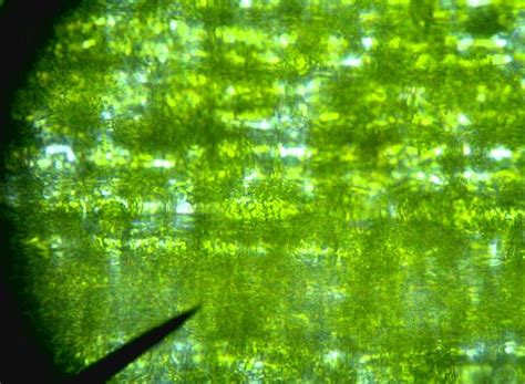 Elodea Cells In An Hypotonic Environment Ap Biology Cell Biology