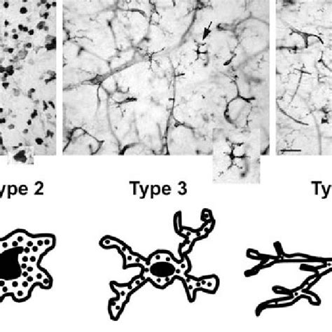 Microglial Cell Types Both Photomicrographs And Drawings Show The