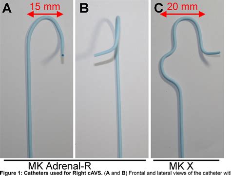 Figure 1 From A Novel Method Super Selective Adrenal Venous Sampling