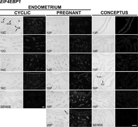 In Situ Hybridization Analysis Of Eif4ebp1 Mrna In Uteri Of Cyclic C