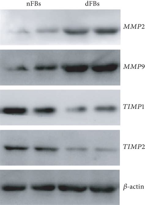 Diabetic Wounds Display Elevated MMP Expression And Reduced TIMP