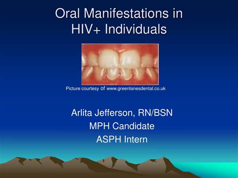 Ppt Oral Health And Hiv Powerpoint Presentation Free Download Id