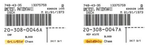 Updated Chemistry Lab Specimen Requirements On Barcode Labels — Putter