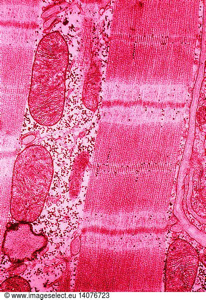 TEM Of Cardiac Muscle Cell TEM Of Cardiac Muscle Cell Cardiac Muscle