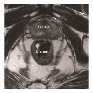 Axial T Weighted Magnetic Resonance Images Of A Patient With A