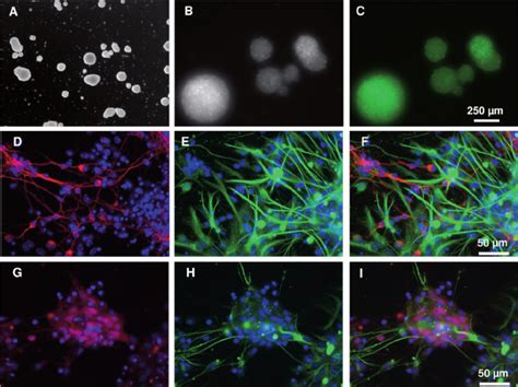 Representative Photographs Of Svz Cell Cultures From Newborn Mice In